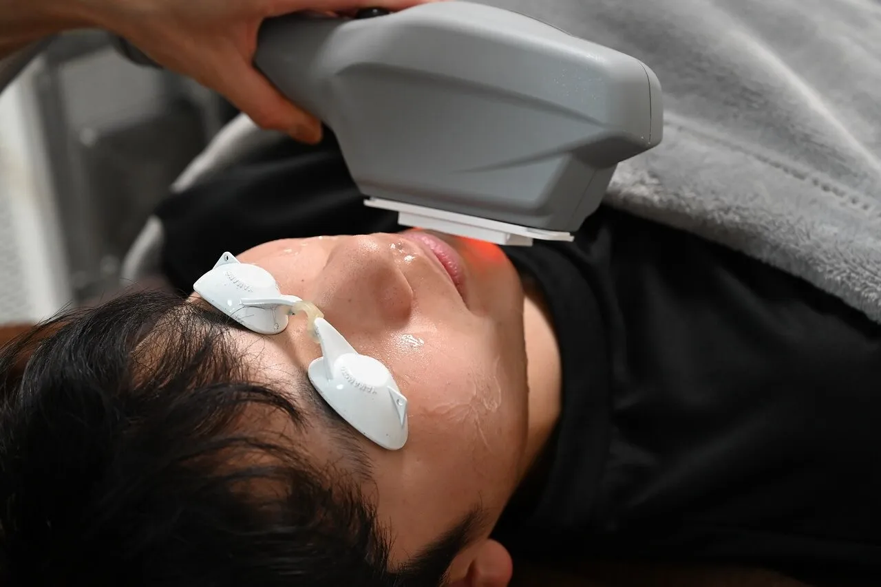 大人気の顔脱毛